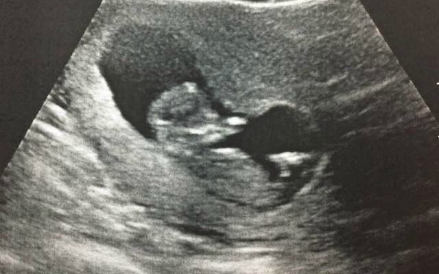 The first look at our beautiful baby- the 12 week ultrasound.